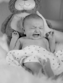 宝宝唇腭裂怎么喂养防呛奶几岁做修补手术